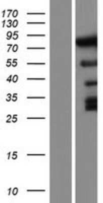 Western Blot: DUSP8 Overexpression Lysate [NBP2-07874]