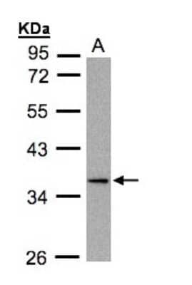 Western Blot: DUSP9 Antibody [NBP1-31227]