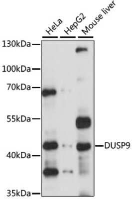 Western Blot: DUSP9 AntibodyAzide and BSA Free [NBP3-05213]