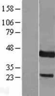 Western Blot: DUSP9 Overexpression Lysate [NBL1-10059]