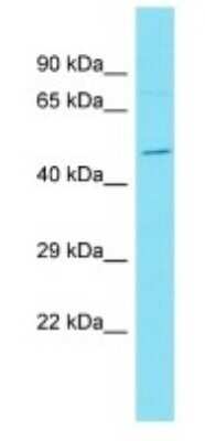 Western Blot: DUX1 Antibody [NBP3-09704]