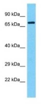 Western Blot: DUX1 Antibody [NBP3-09917]