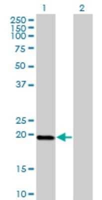 Western Blot: DUX3 Antibody (3D2) [H00026582-M01]