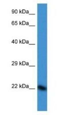 Western Blot: DUX3 Antibody [NBP1-82394]