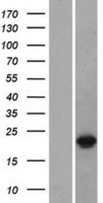 Western Blot: DUX3 Overexpression Lysate [NBP2-07483]