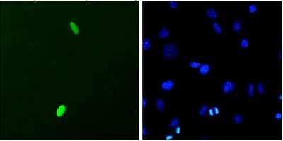 Immunocytochemistry/ Immunofluorescence: DUX4 Antibody (P2B1) [NBP2-12886]