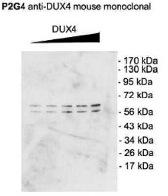 Western Blot: DUX4 Antibody (P2B1) [NBP2-12886]