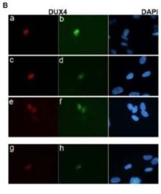 Immunocytochemistry/ Immunofluorescence: DUX4 Antibody (P4H2) - Azide and BSA Free [NBP2-80703]