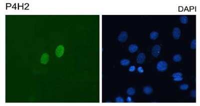 Immunocytochemistry/ Immunofluorescence: DUX4 Antibody (P4H2) - Azide and BSA Free [NBP2-80703]