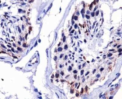 Immunohistochemistry: DUX4 Antibody (P4H2) - Azide and BSA Free [NBP2-80703]