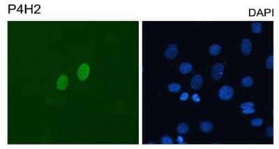 Immunocytochemistry/ Immunofluorescence: DUX4 Antibody (P4H2) - BSA Free [NBP1-49552]