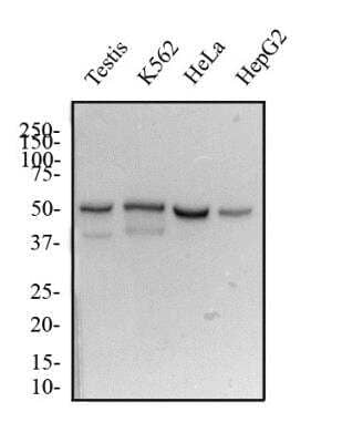 Western Blot: DUX4 Antibody (P4H2)BSA Free [NBP1-49552]