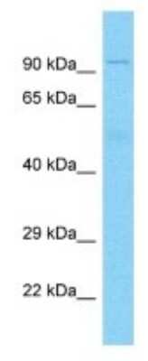 Western Blot: DUX4 Antibody [NBP3-10390]