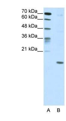 Western Blot: DUX5 Antibody [NBP1-80322]