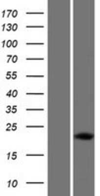 Western Blot: DUX5 Overexpression Lysate [NBP2-07484]