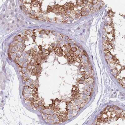 Immunohistochemistry: DXO Antibody [NBP2-47478]