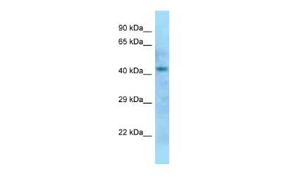 Western Blot: DXO Antibody [NBP2-87313]