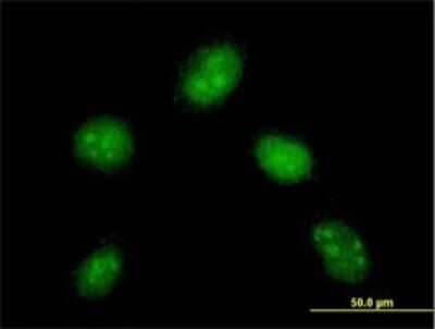 Immunocytochemistry/ Immunofluorescence: DYDC1 Antibody (1B11) [H00143241-M01]