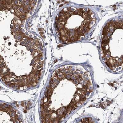 Immunohistochemistry-Paraffin: DYDC1 Antibody [NBP1-88779]
