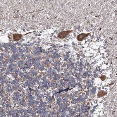 Immunohistochemistry-Paraffin: DYDC1 Antibody [NBP1-88780]