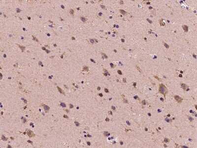 Immunohistochemistry-Paraffin: DYDC1 Antibody [NBP2-97558]