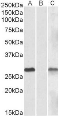 Western Blot: DYDC1 Antibody [NBP1-47218]