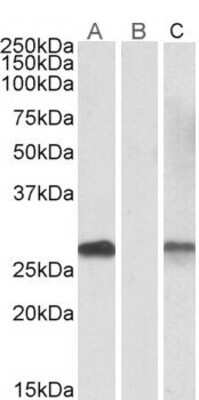 Western Blot: DYDC1 Antibody [NBP1-52002]