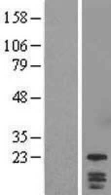 Western Blot: DYDC1 Overexpression Lysate [NBL1-10065]