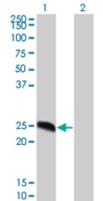 Western Blot: DYDC2 Antibody (8G4) [H00084332-M02]