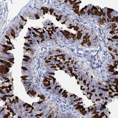 Immunohistochemistry-Paraffin: DYDC2 Antibody [NBP1-88778]