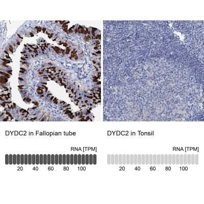 Immunohistochemistry-Paraffin: DYDC2 Antibody [NBP1-88778]