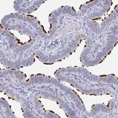 Immunohistochemistry-Paraffin: DYDC2 Antibody [NBP2-38377]