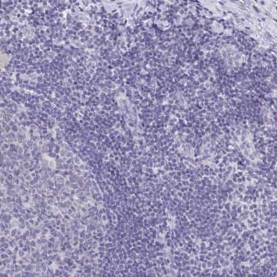 Immunohistochemistry-Paraffin: DYDC2 Antibody [NBP2-38377]
