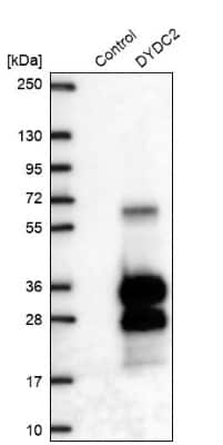 Western Blot: DYDC2 Antibody [NBP1-88778]