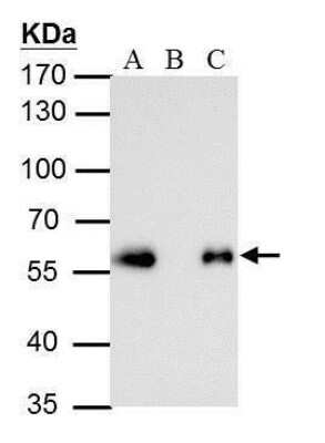 Immunoprecipitation: DYKDDDDK Epitope Tag Antibody (231) [NBP2-43570]