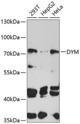 Western Blot: DYM AntibodyBSA Free [NBP3-04582]