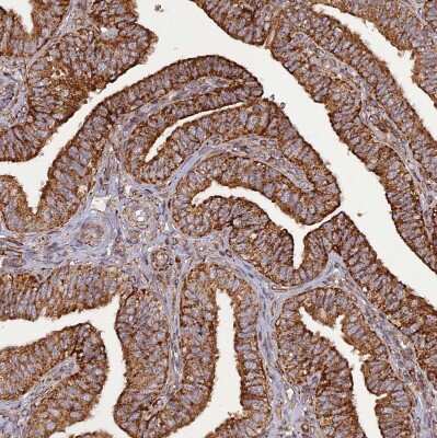 Immunohistochemistry-Paraffin: DYM Antibody [NBP2-13942]
