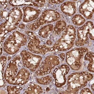 Immunohistochemistry-Paraffin: DYM Antibody [NBP2-13942]