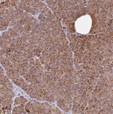 Immunohistochemistry-Paraffin: DYM Antibody [NBP2-13942]
