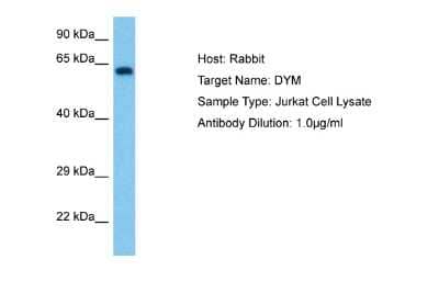 Western Blot: DYM Antibody [NBP2-87314]