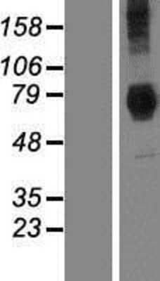 Western Blot: DYM Overexpression Lysate [NBP2-06951]