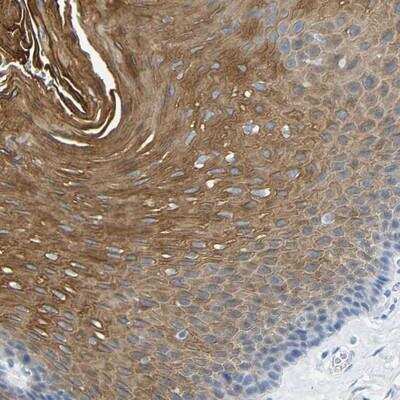 Immunohistochemistry: DYNAP Antibody [NBP1-93793]