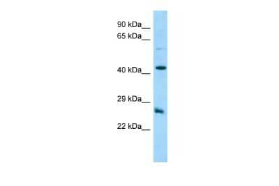 Western Blot: DYNAP Antibody [NBP2-82937]