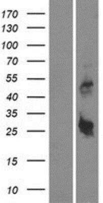 Western Blot: DYNAP Overexpression Lysate [NBP2-05125]