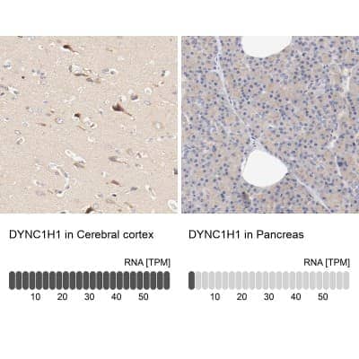 Immunohistochemistry-Paraffin: DYNC1H1 Antibody [NBP1-84254]