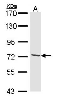 Western Blot: DYNC1I2 Antibody [NBP1-31703]