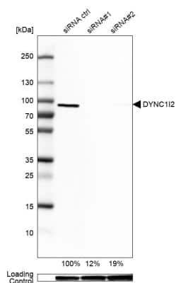 Western Blot: DYNC1I2 Antibody [NBP2-38469]