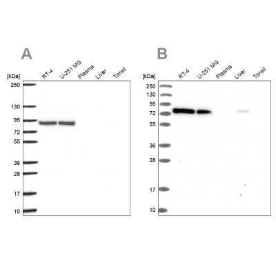 Western Blot: DYNC1I2 Antibody [NBP2-38714]