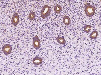 Immunohistochemistry-Paraffin: DYNC1LI1 Antibody [NBP2-97545]