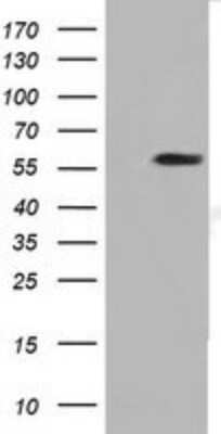 Western Blot: DYNC1LI1 Antibody (OTI2E8)Azide and BSA Free [NBP2-71904]